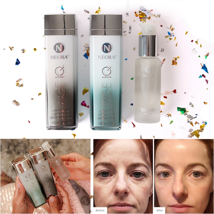 Transformation Set, including Age IQ Day & Night Cream, SIG-1273 Serum with a before and after photo using the products.